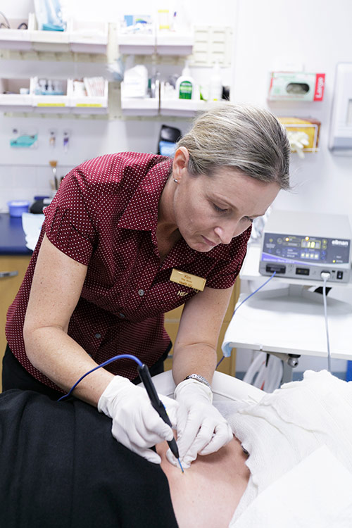 RN Kim uses the Ellman Surgitron to cosmetically remove an unwanted benign mole. This is a quick procedure which is performed under local anaesthetic which entails a small needle injection to numb the area first. RN Kim uses the Ellman Surgitron to cosmetically remove an unwanted benign mole. This is a quick procedure which is performed under local anaesthetic which entails a small needle injection to numb the area first.