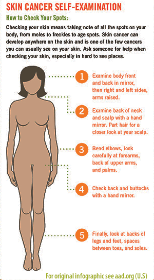 How to check for Skin Cancer infographic
